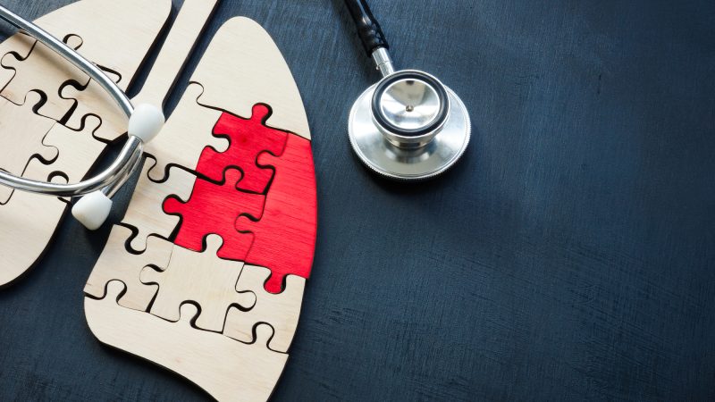 「肺」って英語でなんて言う？lungの意味や「肺炎」「呼吸器」など関連表現もチェック